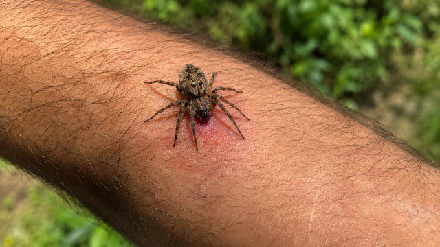 piqûre d'araignée
